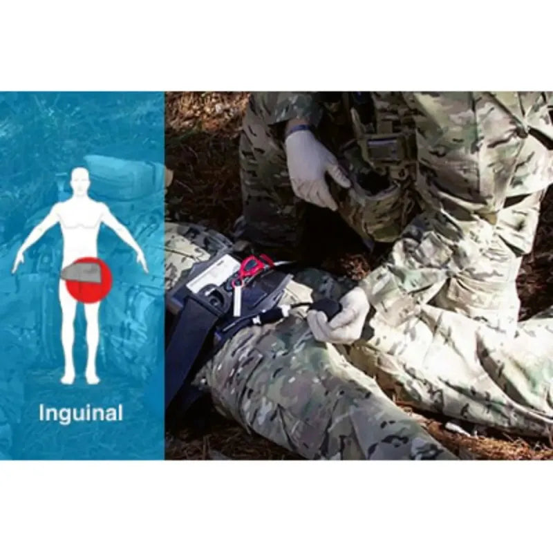 Abdominal Aortic & Junctional Tourniquet-Stabilized (AAJT-S)