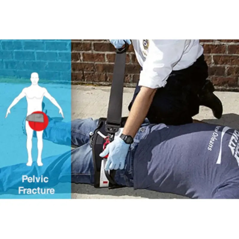 Abdominal Aortic & Junctional Tourniquet-Stabilized (AAJT-S)